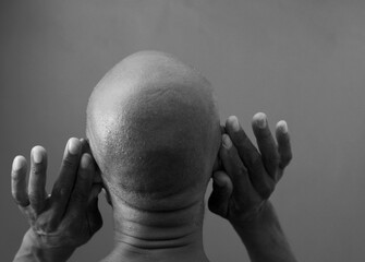 man suffering from deafness and hearing loss on gray background with people stock image stock photo	