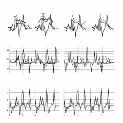 Fototapeta premium heart rhythm set, Electrocardiogram isolated on white background
