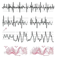 Fototapeta premium heart rhythm set, Electrocardiogram isolated on white background