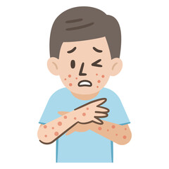 エムポックスに感染した男性のイラスト