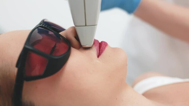 Close-up of a female patient wearing protective glasses during a laser facial hair removal treatment. Advanced depilation technology in a professional aesthetic clinic for smooth, flawless skin.