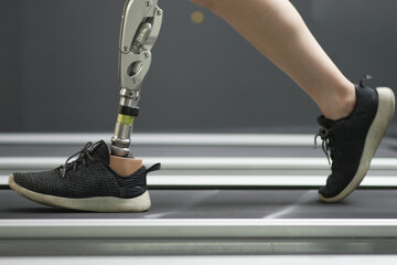 prosthetic, artificial leg. Woman with prosthetic leg using walking on treadmill while working out...