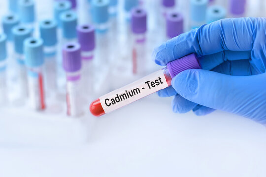 Doctor holding a test blood sample tube with Cadmium (CD test on the background of medical test tubes with analyzes.