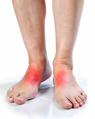 Two people's feet with red marks on them