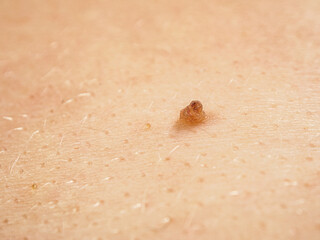 Close-up of skin showing texture and structure, highlighting details important to the study of dermatology