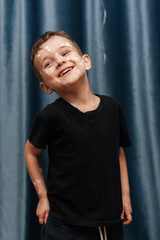 Portrait of a Caucasian boy with chickenpox.