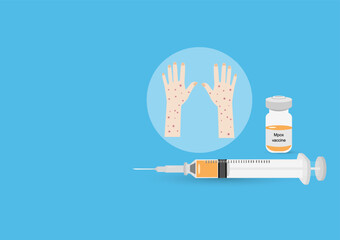 Mpox Vaccine with Infected Skin Illustration
