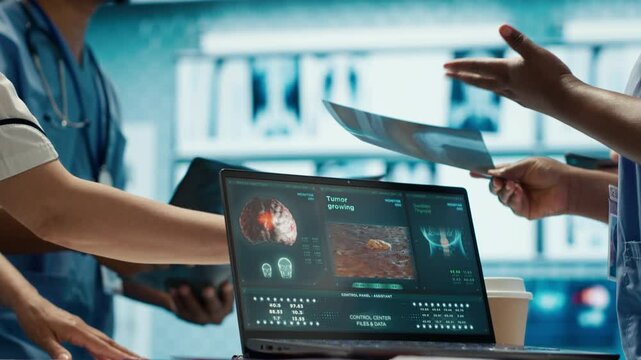 Radiologists team analyze x rays and discuss treatment options in a medical office. Team of licensed healthcare experts working together to provide diagnostic, radiology expertise. Camera A.