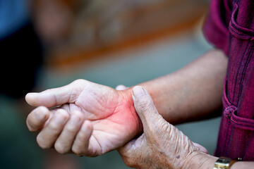 Close-up of a person examining their wrist with visible redness, indicating pain or inflammation....