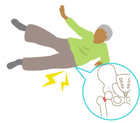 Preferred site of fall fractures in the elderly due to osteoporosis. Fracture of the base of the foot
