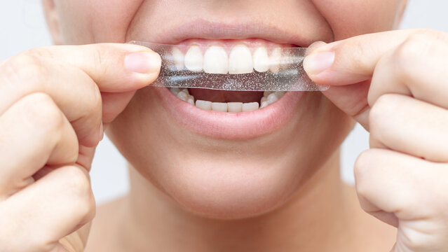 Close up of a young caucasian woman holding a 3d transparent teeth whitening strip to get rid of the dark yellow plaque on a white background. Dentistry, dental care