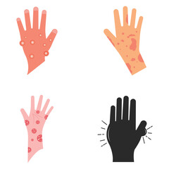 Obraz premium Skin rash, insect bites allergy reaction. irritation on hand logo vector illustration