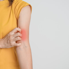 woman itching and scratching itchy arm. Sensitive Skin Allergic reaction to insect bite, food, drug...