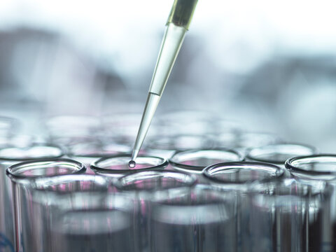 Extraction of samples from test tube using pipette in laboratory