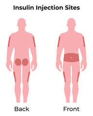 Insulin Injection Sites Science Design Vector Illustration Diagram