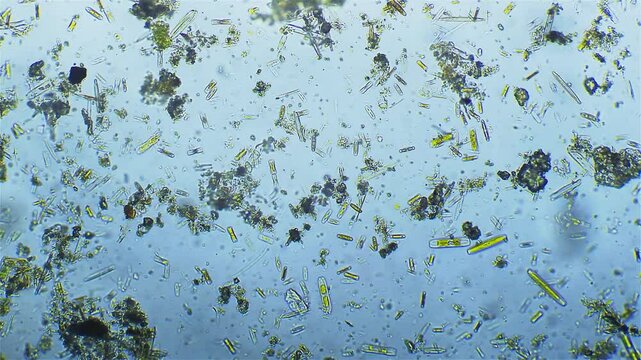 Large groupe of diatoms - microscope magnification 10x
