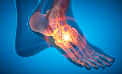 Foot ankle with strong pain symptom - 3D illustration