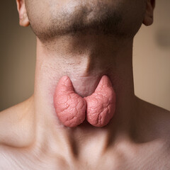 Naklejka premium pictures of swollen thyroid gland in neck