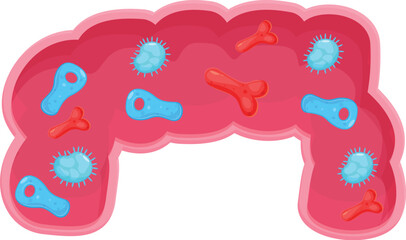 Cartoon bacteria and viruses inside human intestine causing gut inflammation
