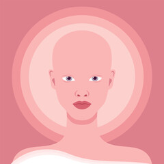 Young woman with alopecia portrait. Beautiful bald girl. Alopecia areata. Vector illustration