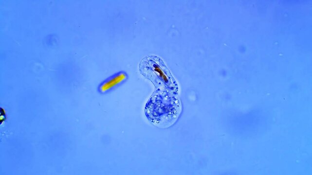 Micro organism Amoeba - magnification 40x