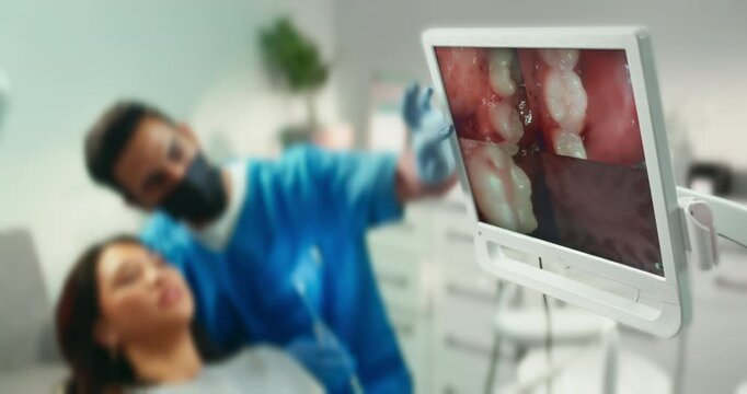 Dental, computer screen and mouth for checkup in clinic with intraoral camera, diagnosis and oral treatment. Dentist, patient and digital for teeth assessment, medical process and braces procedure