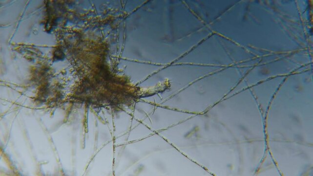 Research Scientists Unicellular Organisms. Soil Microorganisms Under Microscope Including Amoeba, Flagellates, Nematodes, Fungi, Bacteria From Healthy Soil. Bacterias for Carbon Sequestration.