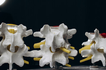 Anatomical spine model on a physiotherapist’s desk. Ideal for showcasing advanced intervertebral hernia treatments and spinal care techniques.