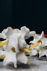 Modern spine model on a physiotherapist’s desk, reflecting advanced treatment methods and...