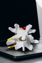 Modern spine model on a physiotherapist’s desk, reflecting advanced treatment methods and...