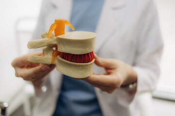 Doctor neurologist holds a mock spine with intervertebral hernia. Spine disease concept and...