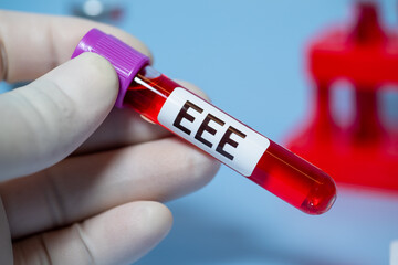 Obraz premium Eastern Equine Encephalitis (EEE) is an extremely rare but serious and often fatal infection that causes encephalitis or inflammation of the brain