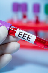 Obraz premium Eastern Equine Encephalitis (EEE) is an extremely rare but serious and often fatal infection that causes encephalitis or inflammation of the brain