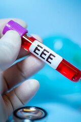 Eastern Equine Encephalitis (EEE) is an extremely rare but serious and often fatal infection that...