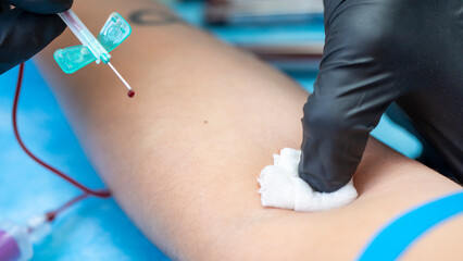 Nurse removing needle from arm of blood donor. Selective focus and copy space