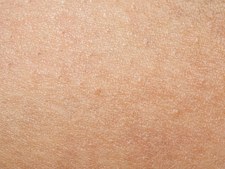 Close-up of skin showing texture and structure, highlighting details important to the study of dermatology