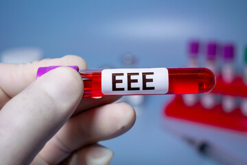 Obraz premium Eastern Equine Encephalitis (EEE) is an extremely rare but serious and often fatal infection that causes encephalitis or inflammation of the brain