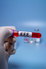 Obraz premium Eastern Equine Encephalitis (EEE) is an extremely rare but serious and often fatal infection that causes encephalitis or inflammation of the brain
