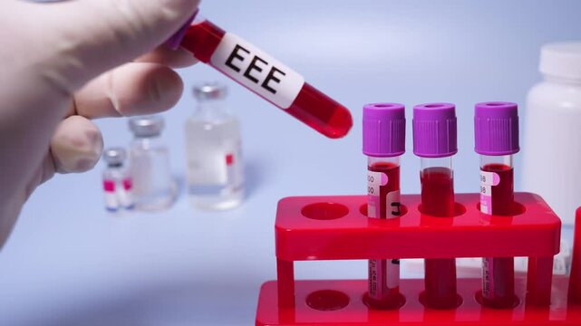 Eastern Equine Encephalitis (EEE) is an extremely rare but serious and often fatal infection that causes encephalitis or inflammation of the brain