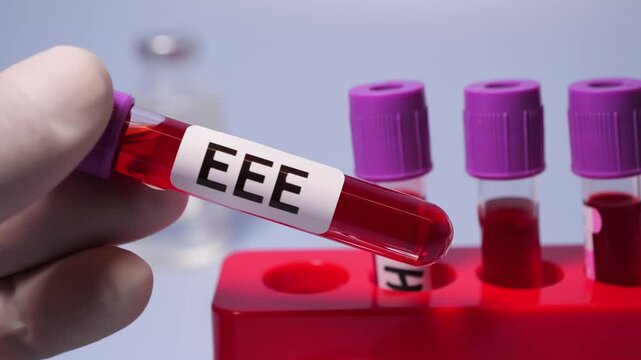 Eastern Equine Encephalitis (EEE) is an extremely rare but serious and often fatal infection that causes encephalitis or inflammation of the brain