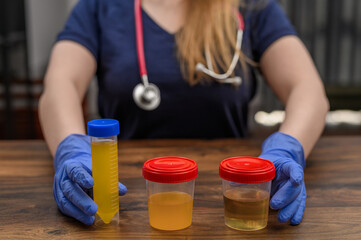 Pojemniki z próbkami moczu do narkotestów, wykrywanie śladowych ilości substancji zakazanych, laboratorium chemiczne 