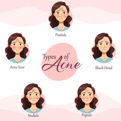 Decoding Acne A Comprehensive Guide to Different Types and Effective Treatments