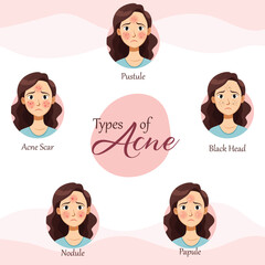 Decoding Acne A Comprehensive Guide to Different Types and Effective Treatments