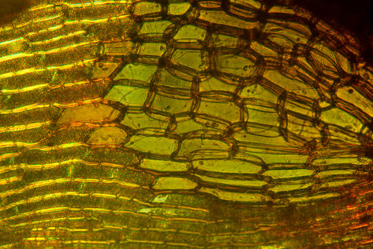 Alar cells of a branch leaf from a broom moss.