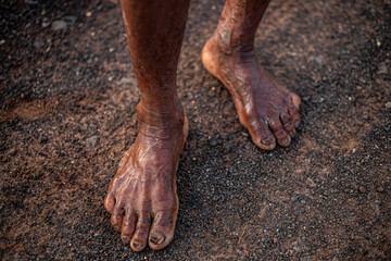 A man's feet are covered in mud and dirt