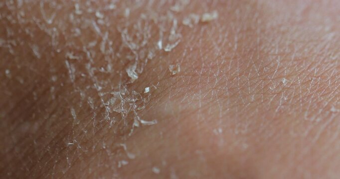 Macro of female dry skin