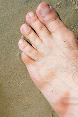 Man's tanned leg, sandal marks, tanned body, black and white leg, through slippers or flip flops on a sunny day, half-tanned body and legs, tan, sunburned foot.