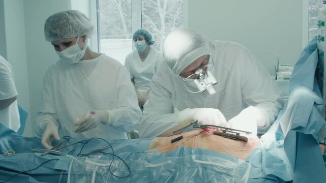 Medical staff performs heart surgery. Surgeon performs life-saving operation to bypass blocked coronary artery ensuring patient heart continues to function