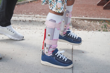 Child cerebral palsy disability, legs orthosis.