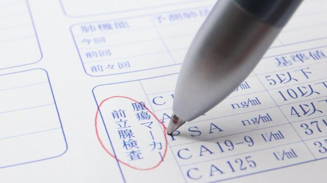 前立腺検査。腫瘍マーカー。前立腺がんの検査。